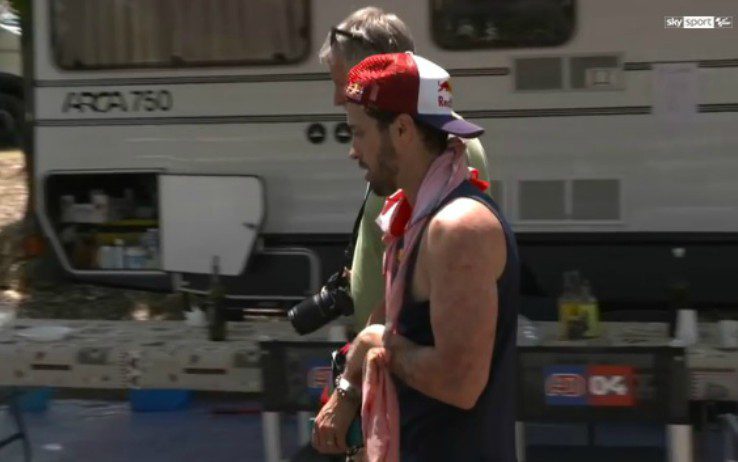 Dr Thiago Martins: tratamento de fratura de  clav&iacute;cula